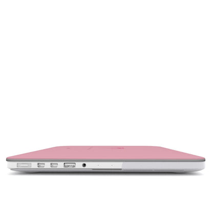 "Tied to Today" MacBook Case