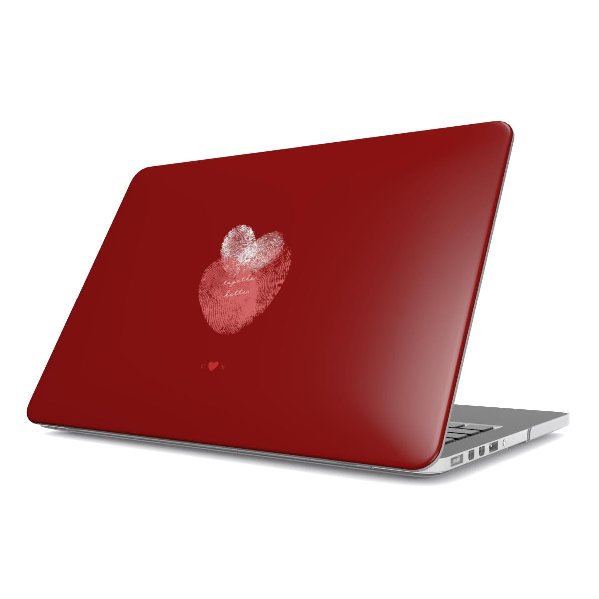 "Together Better" MacBook Case