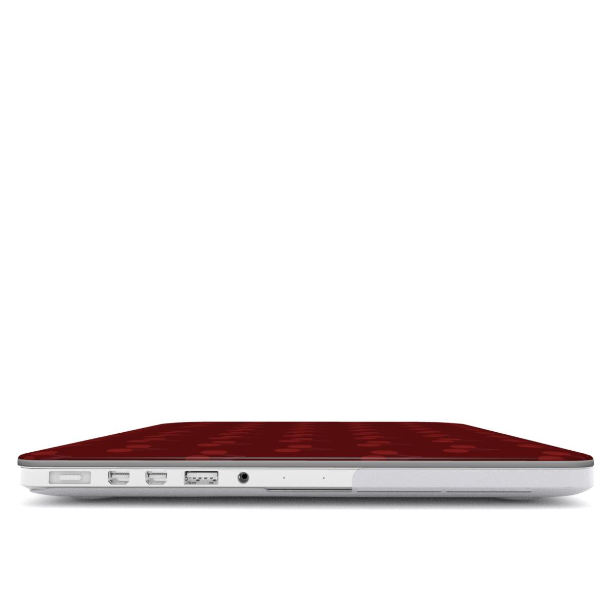 "Sweet Bold" MacBook Case