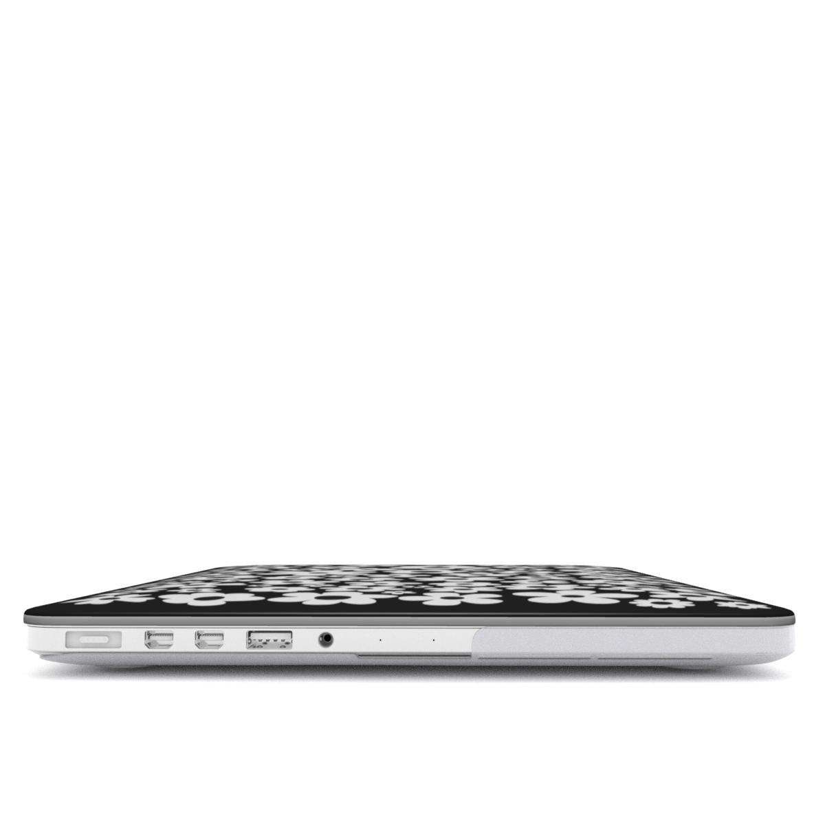 "Flora Pop" MacBook Case