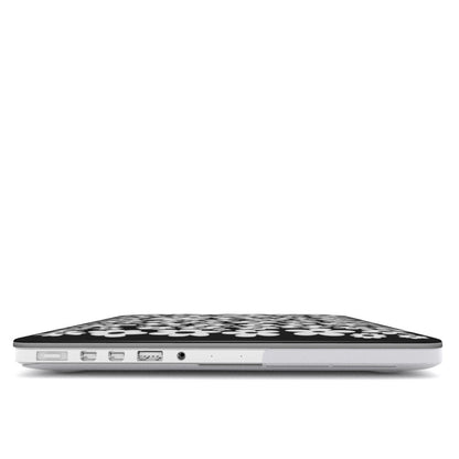 "Flora Pop" MacBook Case